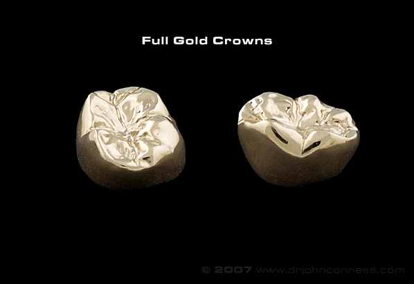 Graphic of two full gold crowns against a black background