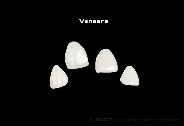 veneers on black background