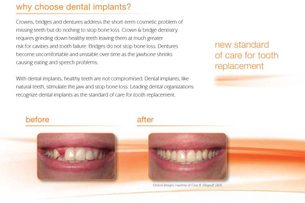 infographic explaining the unique benefits of dental implants