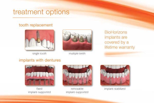 infographic showing all the available dental implant solutions from BIoHorizons
