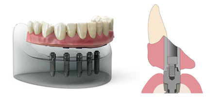 teeth in a day diagram